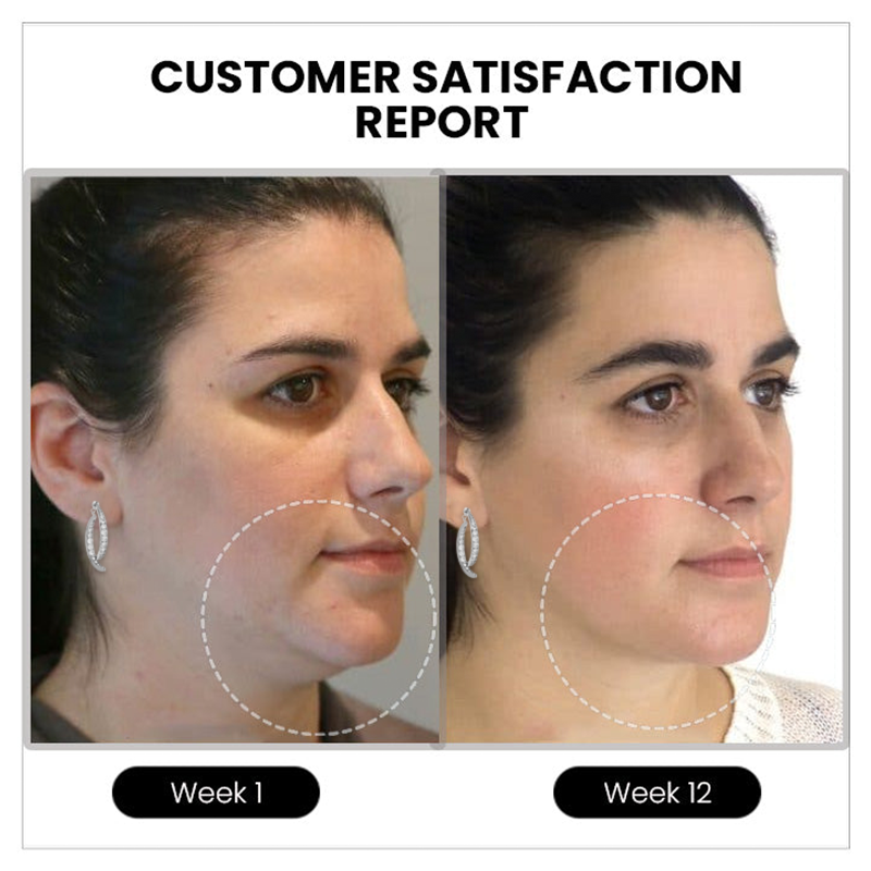 💖💖 LAST DAY SALE-80% OFF💎Czticle® Histone Magnetology Lymphvity Germanium Earrings