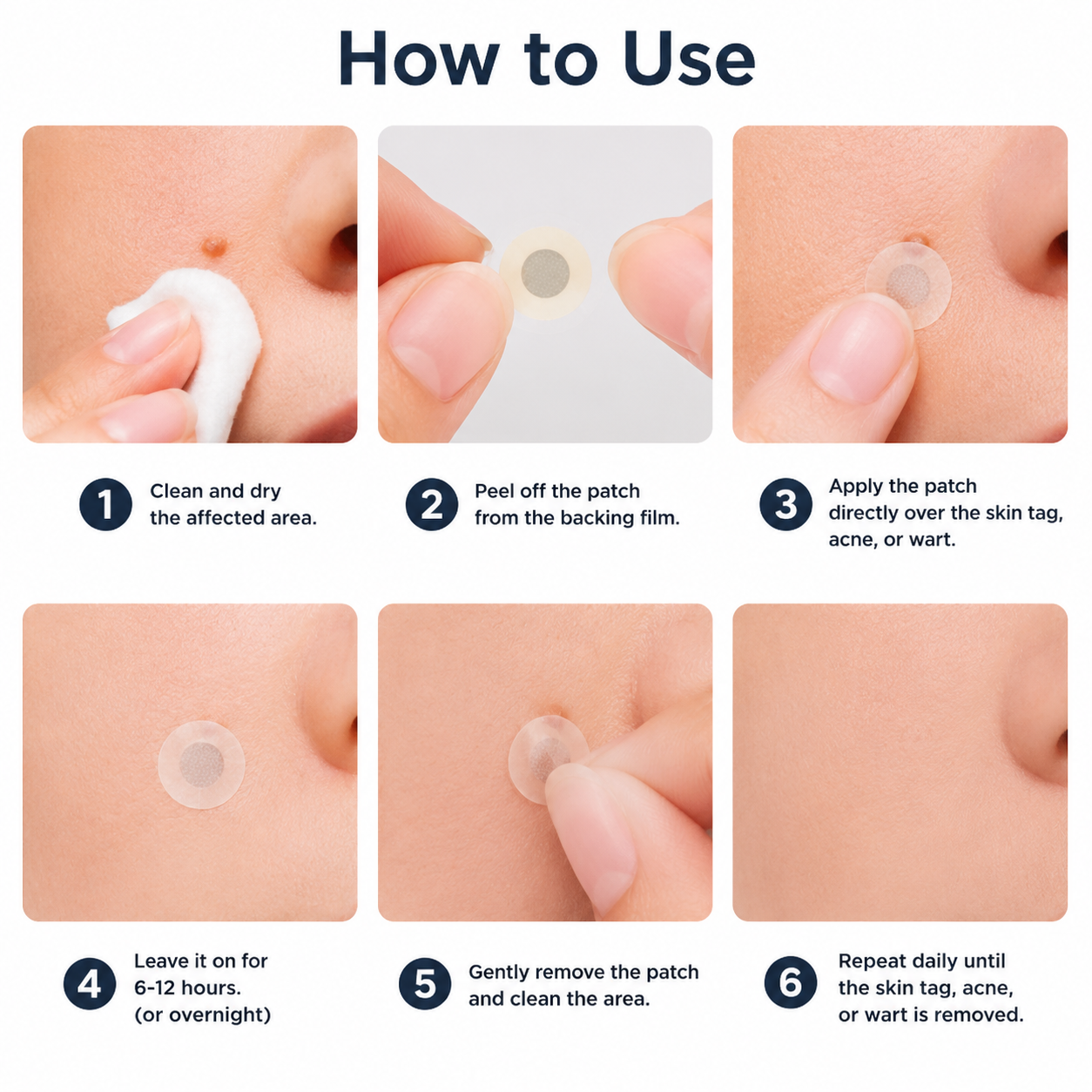 🏥Curalona®2-in-1 Microneedle & Hydrocolloid Patch🍀| Removes Raised Moles, Acne, Flat Warts & Skin Tags | Helps Improve Wrinkles, Scars & Blemishes | Invisible Patches for Face & Body