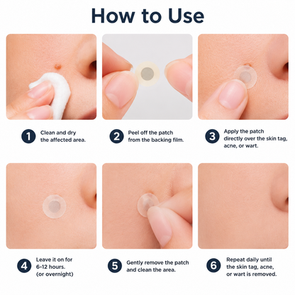 🏥Curalona®2-in-1 Microneedle & Hydrocolloid Patch🍀| Removes Raised Moles, Acne, Flat Warts & Skin Tags | Helps Improve Wrinkles, Scars & Blemishes | Invisible Patches for Face & Body