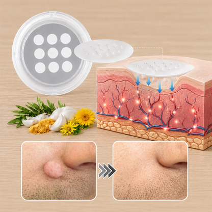 ✨【Dermatologist-Inspired】PURELORA® Bump Eraser Micro-Infusion Patches——For Bumps, Rough Spots, Wart-Like Texture, Blemishes, Fine Lines & Dark Spots