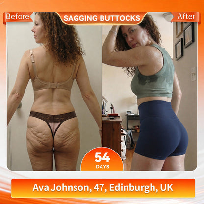 🔥𝑶𝒏𝒍𝒊𝒏𝒆 𝑷𝒉𝒂𝒓𝒎𝒂𝒄𝒚🔥Curalona®  Moringa & Berberine 6-In-1 Hot Cream – Sweat Enhancer & Body Sculpting Cream