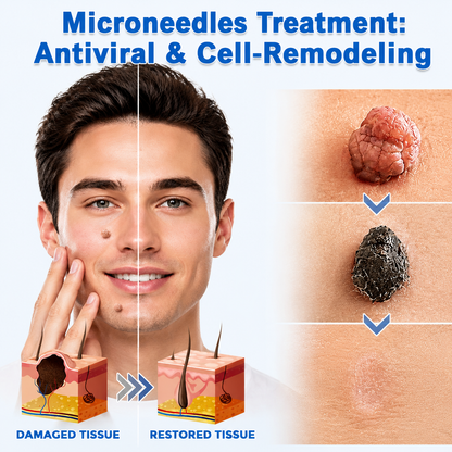 🔥Curalona®2-in-1 Microneedle & Hydrocolloid Patch🍀| Removes Raised Moles, Acne, Flat Warts & Skin Tags | Helps Improve Wrinkles, Scars & Blemishes | Invisible Patches for Face & Body