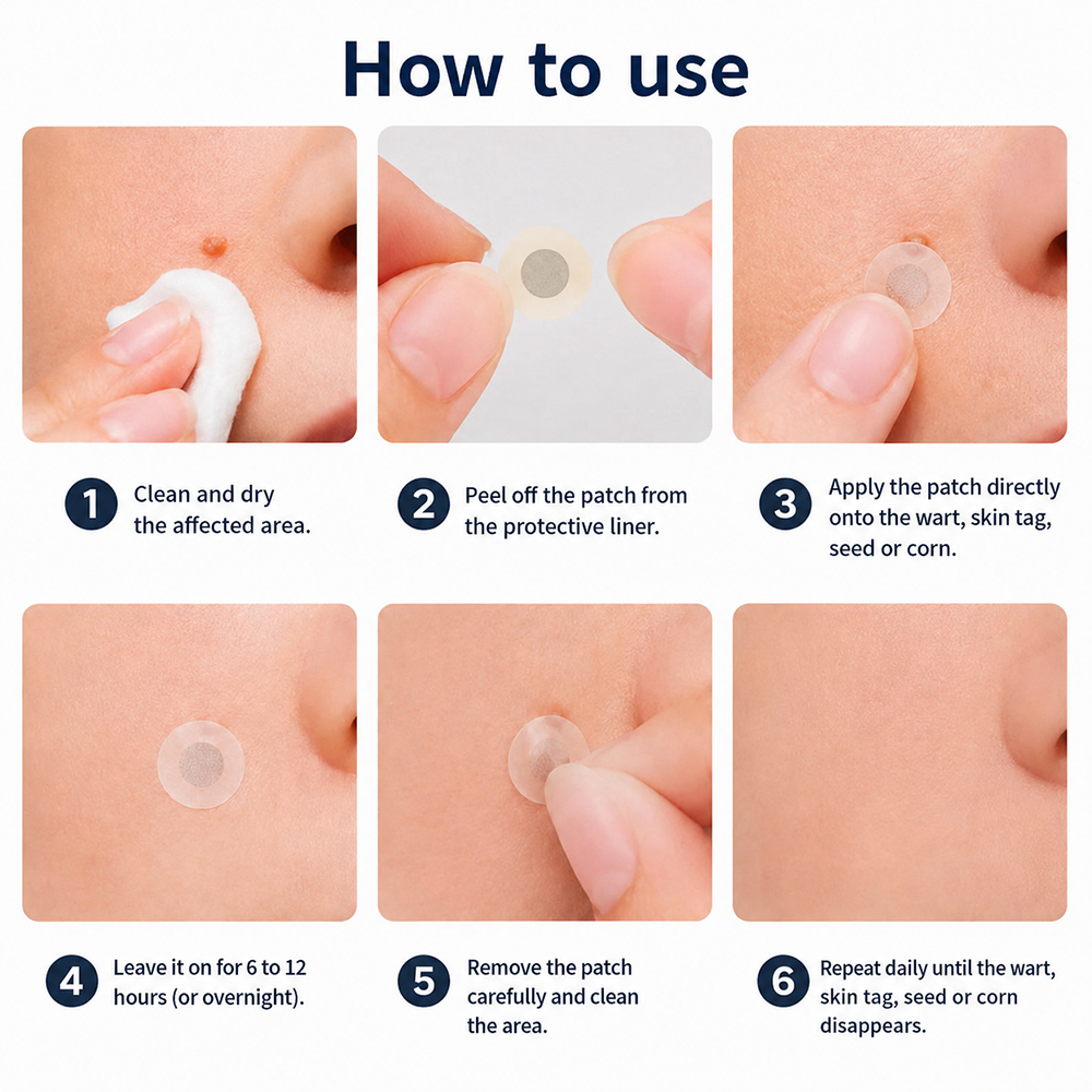 ✨【Dermatologist-Inspired】PURELORA® Bump Eraser Micro-Infusion Patches——For Bumps, Rough Spots, Wart-Like Texture, Blemishes, Fine Lines & Dark Spots